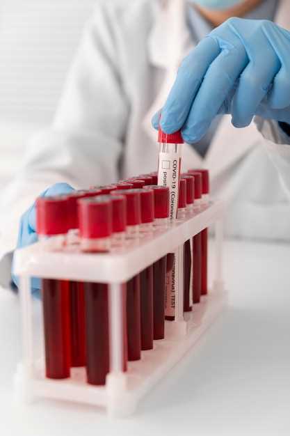 Анализ сепсиса крови: общая информация и цель методики