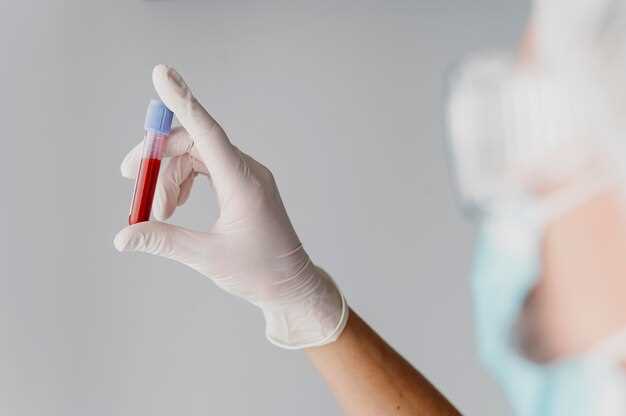 Что такое сепсис крови и почему его анализ важен