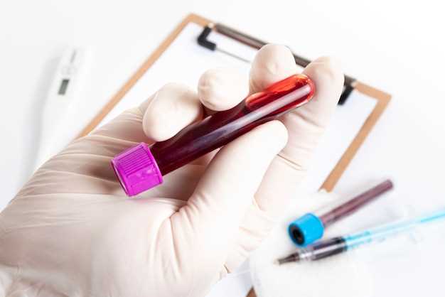 Значение общего анализа крови при диагностике заболеваний