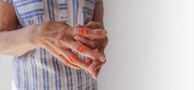 Симптомы немощи руки после инсульта