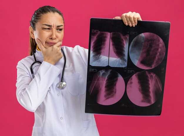 Как определить рак легких по рентгеновским снимкам