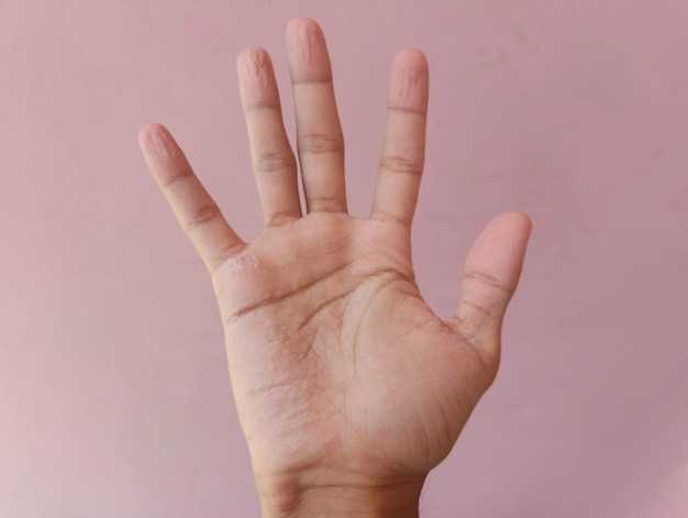Особенности и уход за кожей между пальцами
